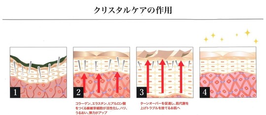 ハーブピーリング（モナリ・クリスタルパック）ならプメハナ鍼灸